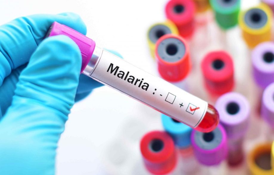 Malaria Test