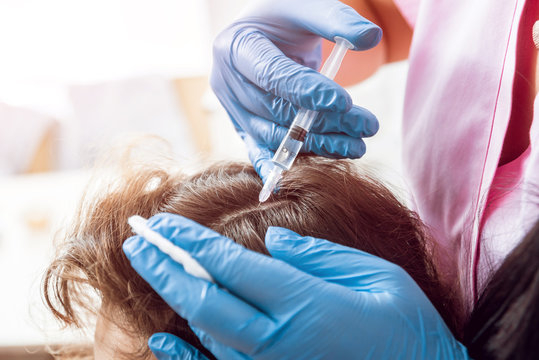 Plasma injection for hairs Dubai